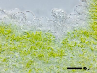 riccia subbifurca swe2 thallus neck canal archegonium cross section