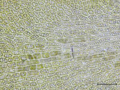 diplophyllum taxifolium zellen