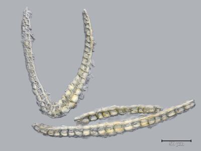 voucher diplophyllum taxifolium blatt quer detail
