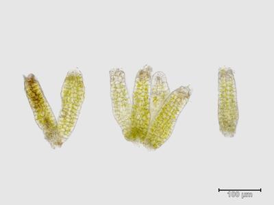 voucher diplophyllum taxifolium frisch archegonien