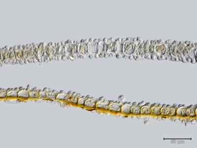 voucher scapania sphaerifera blatt quer detail