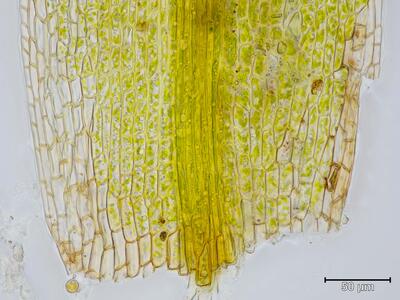 seligeria recurvata blattbasis