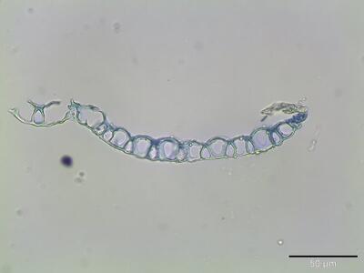 sphagnum angustifolium astblatt querschnitt