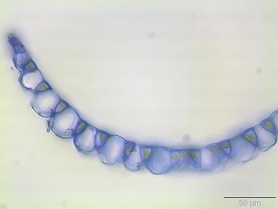sphagnum capillifolium astblatt querschnitt