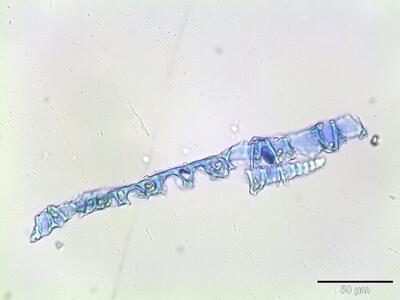 sphagnum fallax stammblatt querschnitt