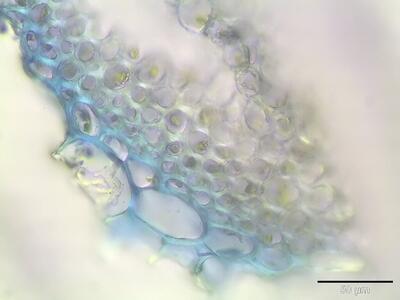 sphagnum fimbriatum stamm querschnitt