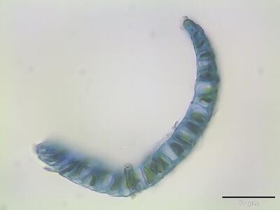 sphagnum flexuosum astblatt querschnitt