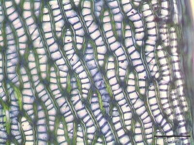 sphagnum flexuosum astblatt zellen