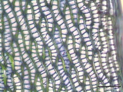 sphagnum flexuosum astblatt zellen