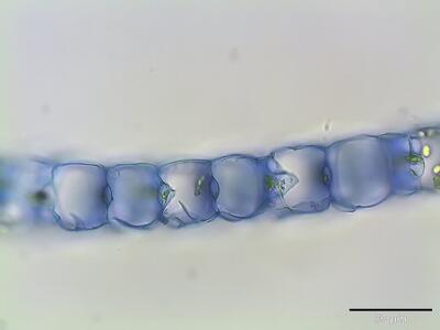 sphagnum magellanicum astblatt querschnitt