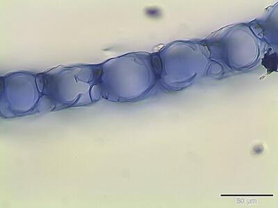 sphagnum palustre astblatt querschnitt