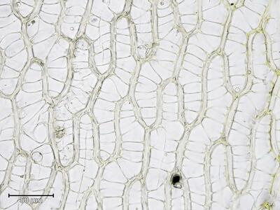 sphagnum papillosum stammblatt zellen oberes blattdrittel