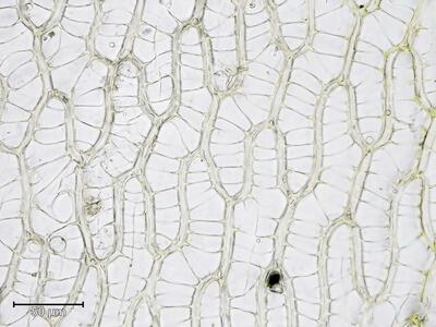 sphagnum papillosum stammblatt zellen oberes blattdrittel