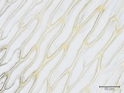 sphagnum papillosum stammblatt zellen unteres blattdrittel