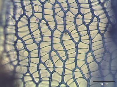 sphagnum rubellum astblatt zellen