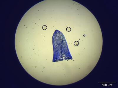 sphagnum rubellum stammblatt