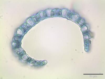 sphagnum subnitens astblatt querschnitt