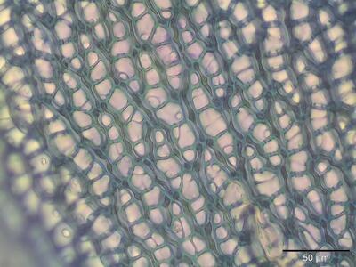 sphagnum subnitens astblatt zellen