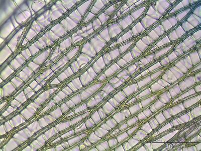 sphagnum subsecundum astblatt zellen