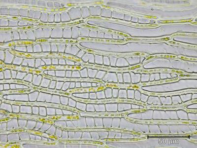 sphagnum viride astblatt zellen