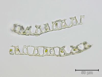 sphagnum viride stammblatt quer