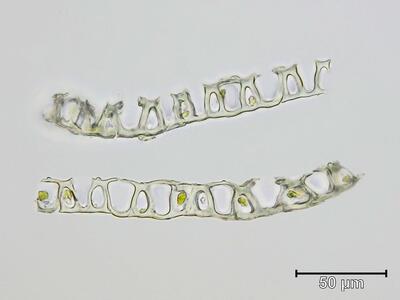 sphagnum viride stammblatt quer