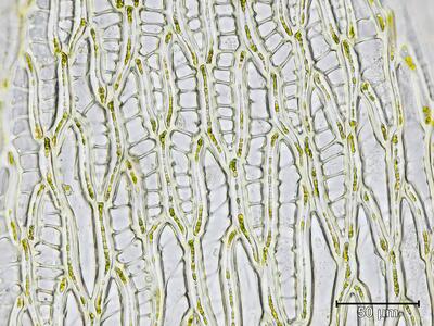 sphagnum viride stammblatt zellen