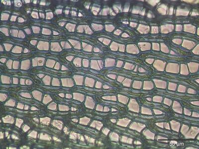 sphagnum warnstorfii astblatt zellen
