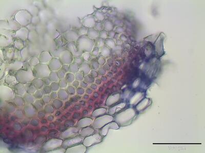 sphagnum warnstorfii stamm querschnitt