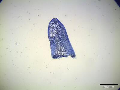 sphagnum warnstorfii stammblatt