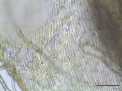 helodium blandowii astblatt zellen